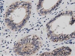 DNAJA2 Antibody (OTI3A10), Novus Biologicals 0.1mL; Unlabeled:Antibodies,