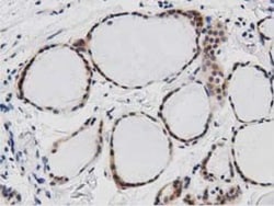 DNAJA2 Antibody (OTI3A10), Novus Biologicals 0.1mL; Unlabeled:Antibodies,
