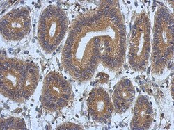 DNAJB12 Antibody, Novus Biologicals 0.1mL; Unlabeled:Antibodies, Polyclonal