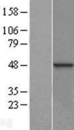 Novus Biologicals&trade;&nbsp;DNAJB12 Overexpression Lysate