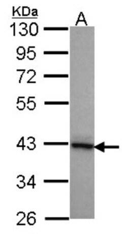 DNAJB2 Antibody, Novus Biologicals 0.1mg; Unlabeled:Antibodies, Polyclonal