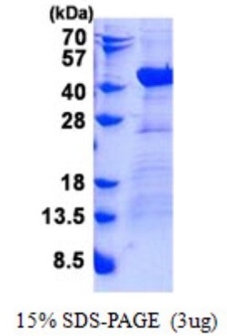 Novus Biologicals&trade;&nbsp;Recombinant Human DNAJB4 His Protein