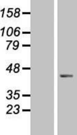 Novus Biologicals&trade;&nbsp;DNAJB5 Overexpression Lysate
