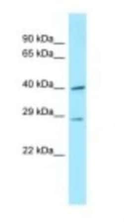 DNAJC11 Antibody, Novus Biologicals 100&mu;L; Unlabeled:Antibodies, Polyclonal