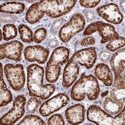 DNAJC16 Antibody, Novus Biologicals 0.1mL; Unlabeled:Antibodies, Polyclonal