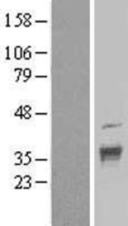 Novus Biologicals&trade;&nbsp;DNAJC17 Overexpression Lysate