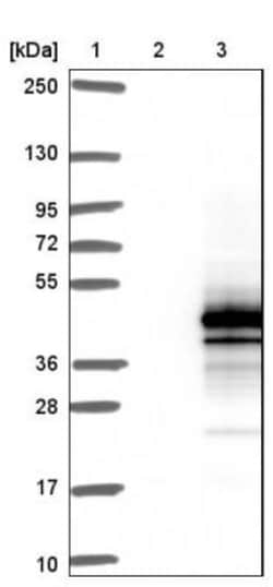 DNAJC18 Antibody, Novus Biologicals 0.1mL; Unlabeled:Antibodies, Polyclonal