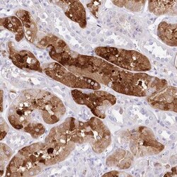 DNAJC19 Antibody, Novus Biologicals:Antibodies:Primary Antibodies