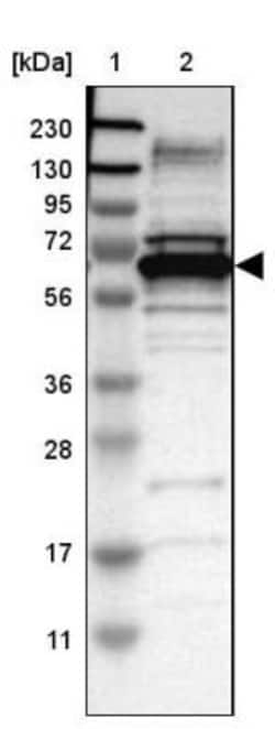 DNAJC1 Antibody, Novus Biologicals 25ul | Buy Online | Novus Biologicals | Fisher Scientific