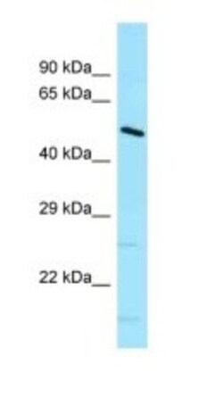 DNAJC21 Antibody, Novus Biologicals 20&mu;L; Unlabeled:Antibodies, Polyclonal