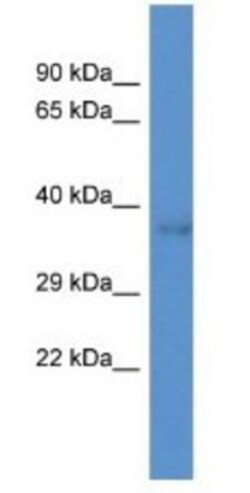 DNAJC22 Antibody, Novus Biologicals 20&mu;L; Unlabeled:Antibodies, Polyclonal