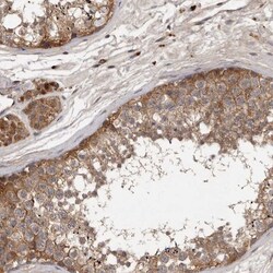 DNAJC28 Antibody, Novus Biologicals 25 &mu;L | Buy Online | Novus Biologicals | Fisher Scientific