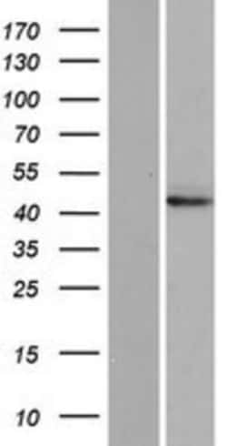 Novus Biologicals&trade;&nbsp;DNAJC28 Overexpression Lysate