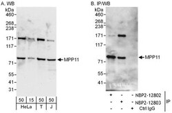 DNAJC2 Antibody, Novus Biologicals 0.1mg; Unlabeled:Antibodies, Polyclonal
