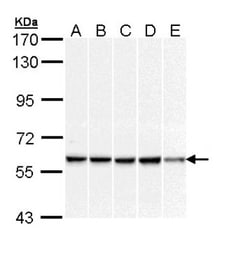 DNAJC3 Antibody, Novus Biologicals 0.1mL; Unlabeled:Antibodies, Polyclonal