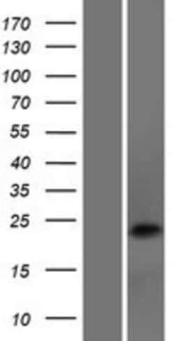 Novus Biologicals&trade;&nbsp;DNAJC5B Overexpression Lysate