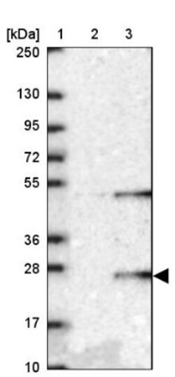 DNAJC5G Antibody, Novus Biologicals 0.1mL; Unlabeled:Antibodies, Polyclonal