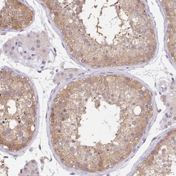 DNAJC5G Antibody, Novus Biologicals 0.1mL; Unlabeled:Antibodies, Polyclonal