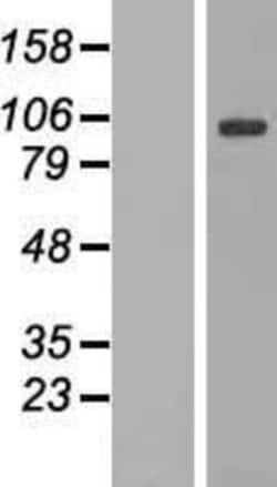 Novus Biologicals&trade;&nbsp;DNAJC6 Overexpression Lysate