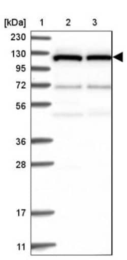 DNAJC6 Antibody, Novus Biologicals 25 &mu;L; Unlabeled:Antibodies, Polyclonal