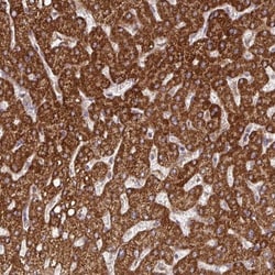 DNAJC7 Antibody, Novus Biologicals 25 &mu;L, Unlabeled:Antibodies, Polyclonal