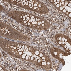 DNAJC8 Antibody, Novus Biologicals 0.1mL; Unlabeled:Antibodies, Polyclonal