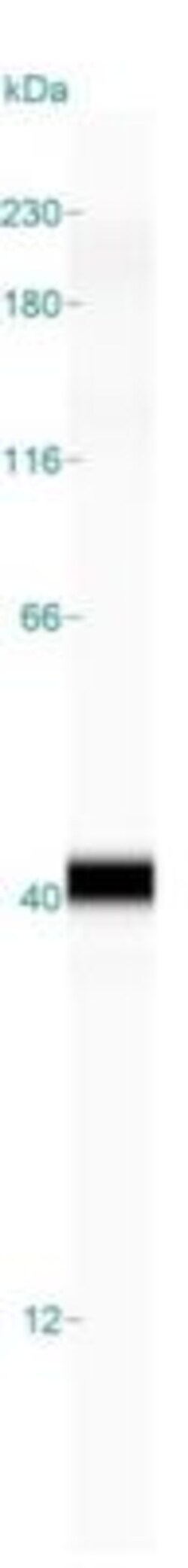 DNAJC8 Antibody, Novus Biologicals 0.1mL; Unlabeled:Antibodies, Polyclonal