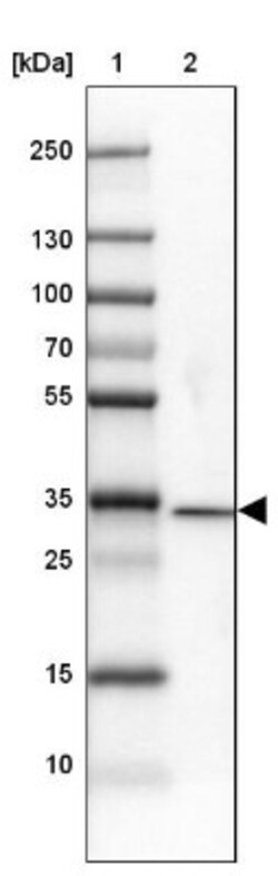 DNAJC8 Antibody, Novus Biologicals 0.1mL; Unlabeled:Antibodies, Polyclonal