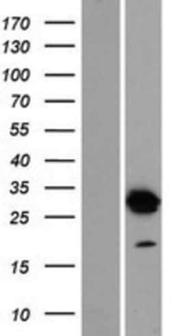 Novus Biologicals™ DNALI1 Overexpression Lysate
