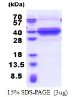 Novus Biologicals&trade;&nbsp;Recombinant Human DNALI1 His Protein