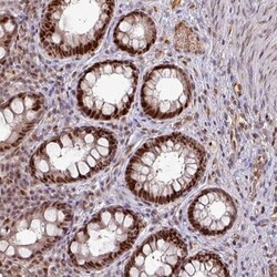 DNA Polymerase delta, catalytic subunit Antibody, Novus Biologicals 25
