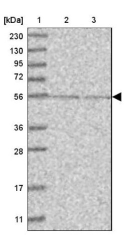 DNA Polymerase epsilon p59 Antibody, Novus Biologicals:Antibodies:Primary