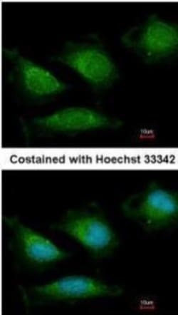 DNA Polymerase gamma Antibody, Novus Biologicals 0.1mL; Unlabeled:Antibodies,
