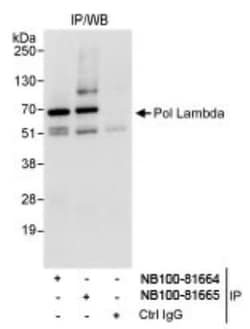 DNA Polymerase lambda Antibody, Novus Biologicals 100 &mu;L | Buy Online | Novus Biologicals | Fisher Scientific