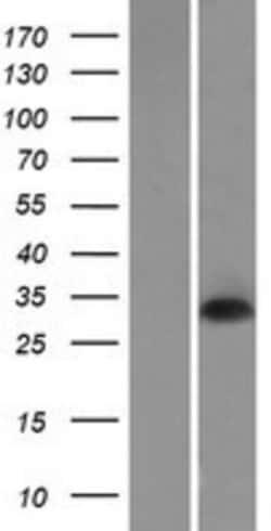Novus Biologicals&trade;&nbsp;DNASE1L2 Overexpression Lysate