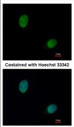 DNASE1L3 Antibody, Novus Biologicals 0.1mL; Unlabeled:Antibodies, Polyclonal