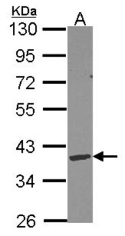 DNASE1L3 Antibody, Novus Biologicals 0.1mL; Unlabeled:Antibodies, Polyclonal