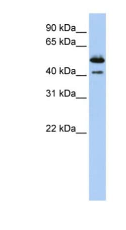 DNASE2B Antibody, Novus Biologicals 100&mu;L; Unlabeled:Antibodies, Polyclonal