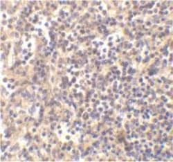 DNase II Antibody, Novus Biologicals 0.1mg; Unlabeled:Antibodies, Polyclonal