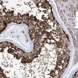 DYNC1LI1 Antibody, Novus Biologicals 0.1mL; Unlabeled:Antibodies, Polyclonal