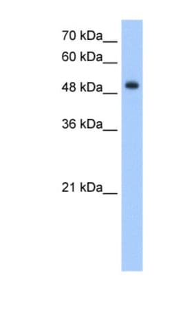 DNER Antibody, Novus Biologicals 100&mu;L; Unlabeled:Antibodies, Polyclonal