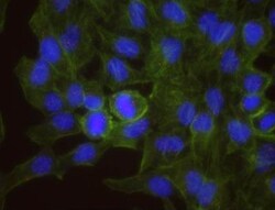 DNMT1 Antibody, Novus Biologicals 100 &mu;L | Buy Online | Novus Biologicals | Fisher Scientific