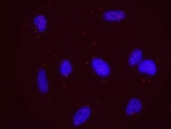 DNMT1 Antibody, Novus Biologicals 100 &mu;L | Buy Online | Novus Biologicals | Fisher Scientific