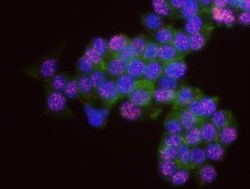 DNMT1 Antibody, Novus Biologicals 100 &mu;L | Buy Online | Novus Biologicals | Fisher Scientific