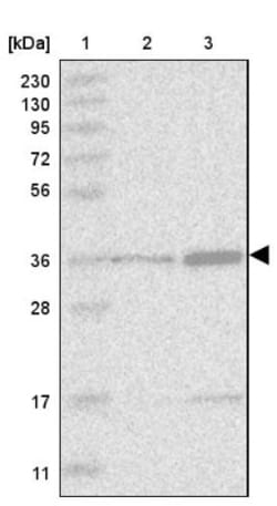 Dnmt2 Antibody, Novus Biologicals 25 &mu;L; Unlabeled:Antibodies, Polyclonal