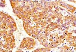 DNMT3A Antibody (64B1446) - BSA Free, Novus Biologicals:Antibodies:Primary