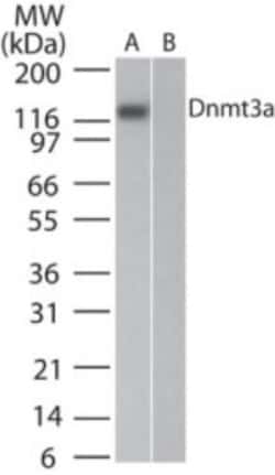 DNMT3A Antibody (64B814.1), Novus Biologicals 0.1mg; Unlabeled:Antibodies,