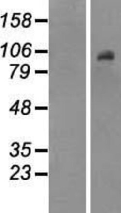 Novus Biologicals&trade;&nbsp;DNMT3B Overexpression Lysate