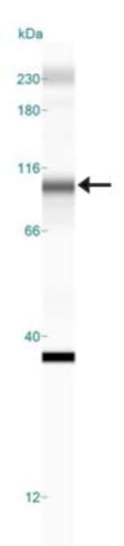 DNMT3B Antibody, Novus Biologicals 0.025 mg, Unconjugated:Antibodies, Polyclonal
