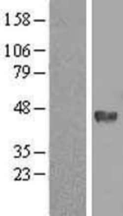 Novus Biologicals&trade;&nbsp;Dnmt3L Overexpression Lysate